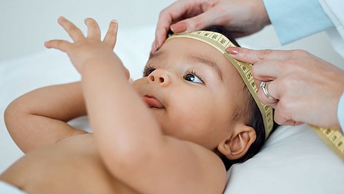 Baby mit Messband um den Kopf